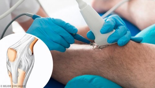 Vorteile der Kniearthroskopie