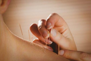 Gesundheitliche Vorzüge von Akkupunktur