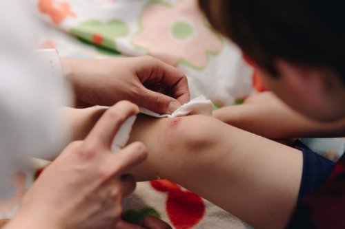 Kind hat ein aufgeschrammtes Knie