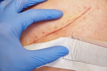 Grundtechniken zur Schließung von Wunden