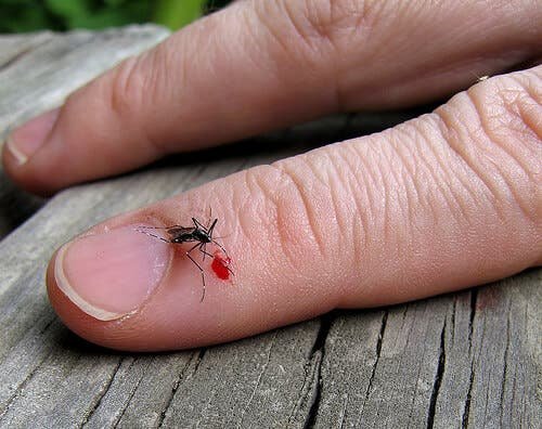 medizinische Kohle - Insektenbiss