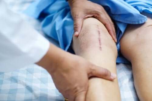 Genesung nach Operation am Knie