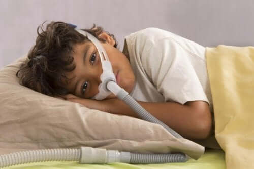 Obstruktives Schlafapnoe-Syndrom bei Kindern