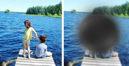 Altersbedingte Makuladegeneration: Was ist das?