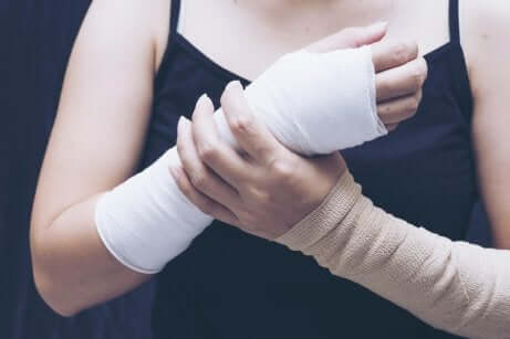 Gips und Schiene: Frau mit zwei verbundenen Armen