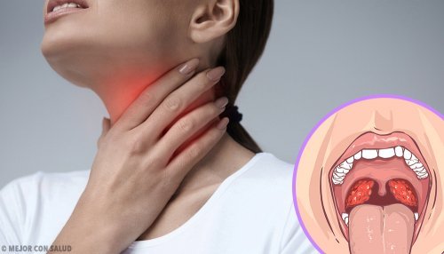 Abszess am Zahn: Symptome und Diagnose