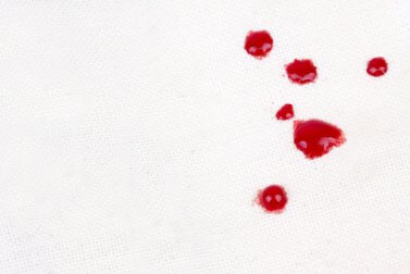 Tomatenflecken so schnell wie möglich entfernen