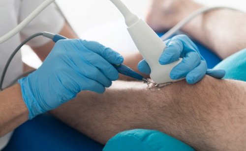 Symptome der Osetoarthritis am Kniegelenk
