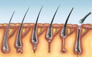 Wissenswertes über Multiple Pilomatrixome