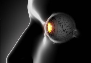 Schielen: Symptome und Ursachen