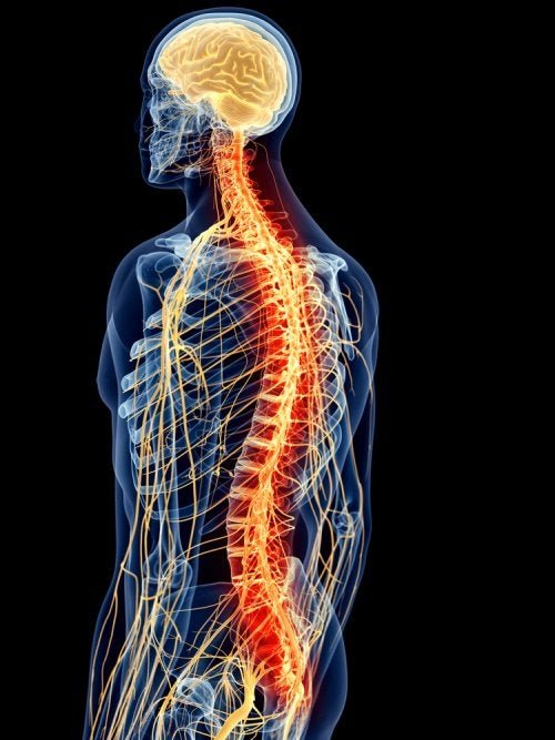 Aceclofenac zur Behandlung von Spondylitis ankylosans