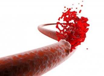 Die Gefahr einer postoperativen Blutung