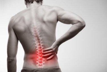 Spondylitis ankylosans (Morbus Bechterew): Diagnose und Behandlung