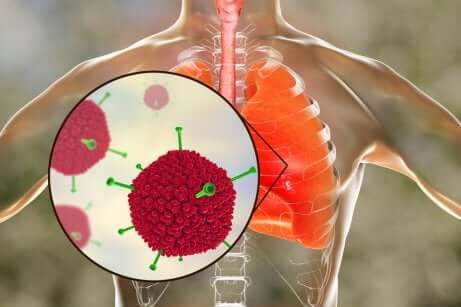 Das Schwere Akute Respiratorische Syndrom: Ursachen