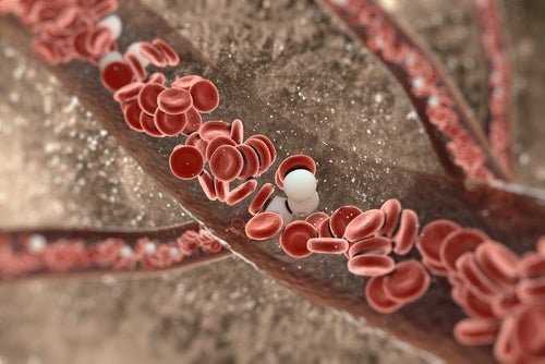 Wie wird eine Verletzung der Aorta diagnostiziert?