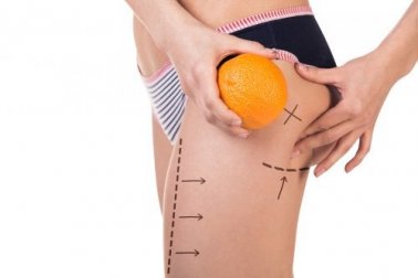 Mit Ernährung gegen Orangenhaut