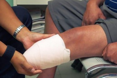 Suprakondyläre Amputation: Definition und Eingriff
