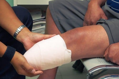 Suprakondyläre Amputation: Definition und Eingriff
