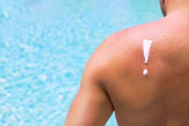 4 schädliche Wirkungen der Sonne auf deine Haut