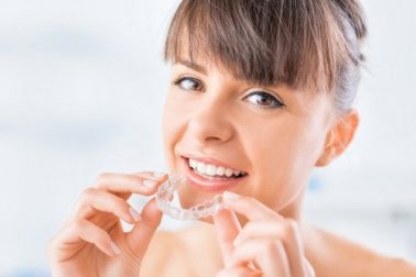 Wissenswertes über unsichtbare Zahnspangen