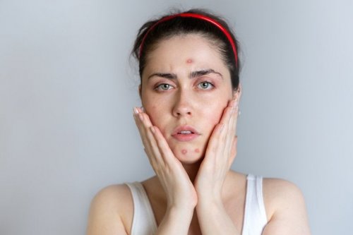 Warum kommt es während der Menstruation zu Akne?