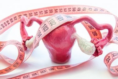 Adenomyosis uteri: Symptome und Behandlung