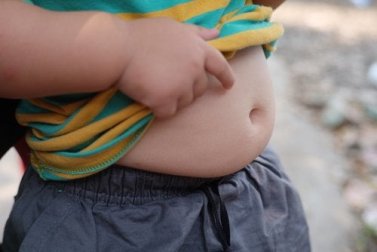 Adipositas in der Kindheit: zunehmendes Problem