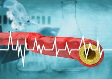 Ernährung bei erhöhtem Cholesterinspiegel