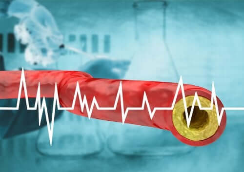 Ernährung bei erhöhtem Cholesterinspiegel