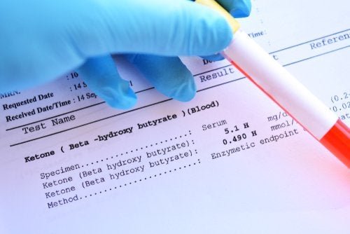 Metabolische Azidose: Ursachen und Behandlung
