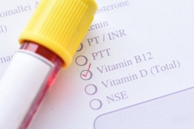 Wissenswertes über die Methylmalonazidurie