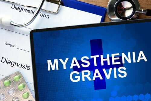 Wissenswertes über Myasthenia gravis