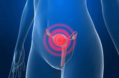 Ursachen für Adenomyosis uteri