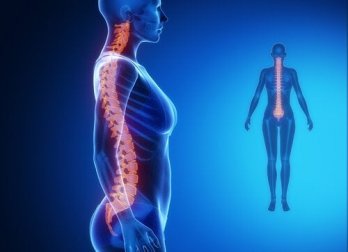 Wirbelsäulenarthrose: Entstehung und Behandlung