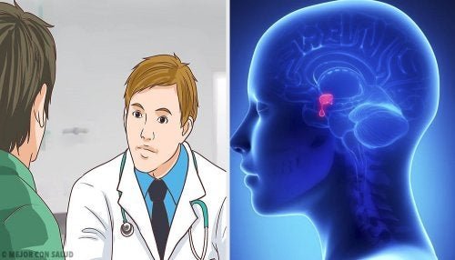 Hypophysenadenom: Symptome