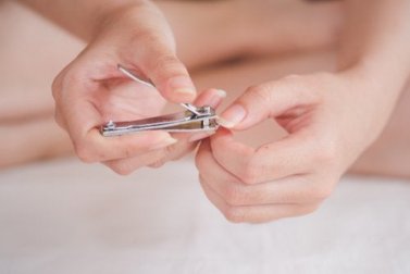 Onychokryptosis: Vorsorge und Behandlung