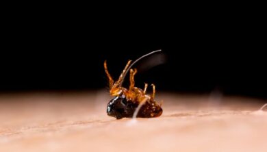 Tungiasis: Symptome und Behandlung