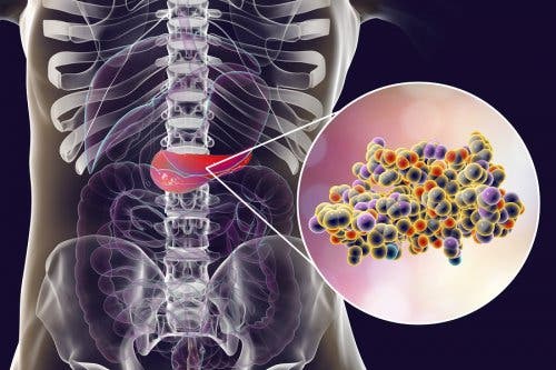 Insulin-Pens bei Diabetes