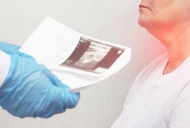 Schilddrüsenknoten: Symptome und Ursachen