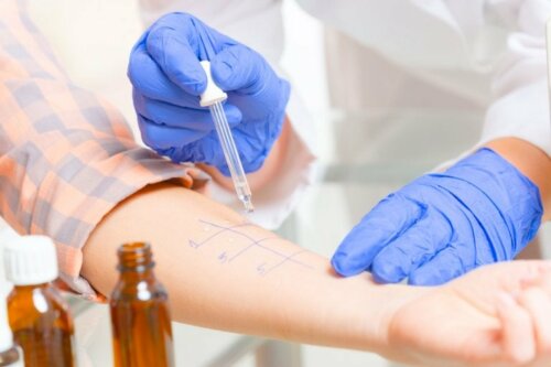 Test um zu prüfen, ob die Person allergisch ist