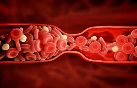 Nebenwirkungen bei der Behandlung mit Atorvastatin