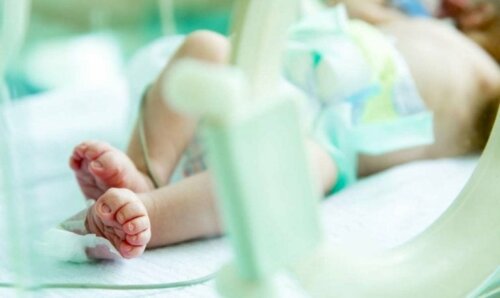 Gastroschisis: Diagnose und Behandlung