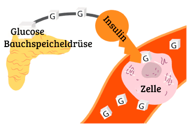 Ursachen für eine Hypoglykämie