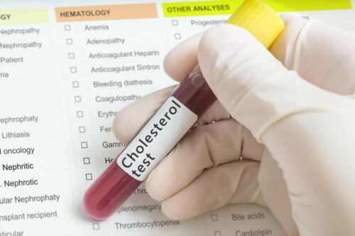 Cholesterin und Ernährung: Sind Lebensmittel mit Cholesterin schädlich?