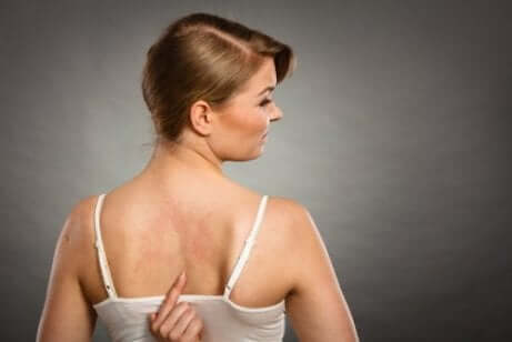 Frau mit Allergie durch Zusatzstoffe