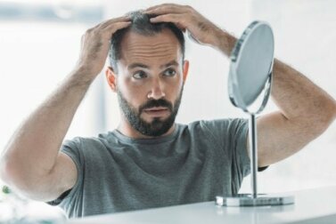 Androgenetische Alopezie: Ursachen, Symptome und Behandlung
