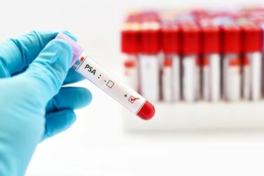 Wie erfolgt eine Prostatauntersuchung?