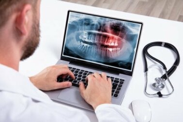 Hyperdontie: Ursachen und Behandlung
