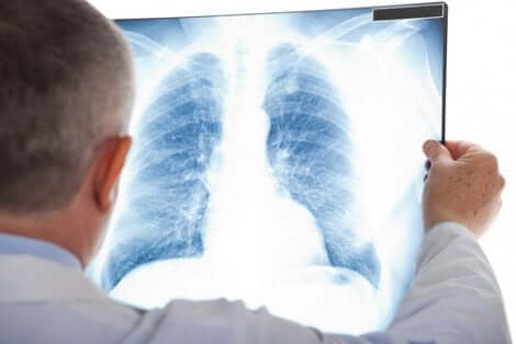 Lungenknoten im Röntgenbild beobachten