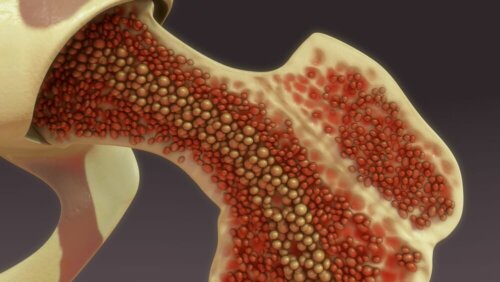 stammzellentherapie